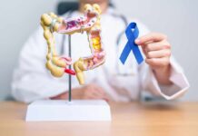 Colorectal Cancer CRISIS: Young Adults at Risk